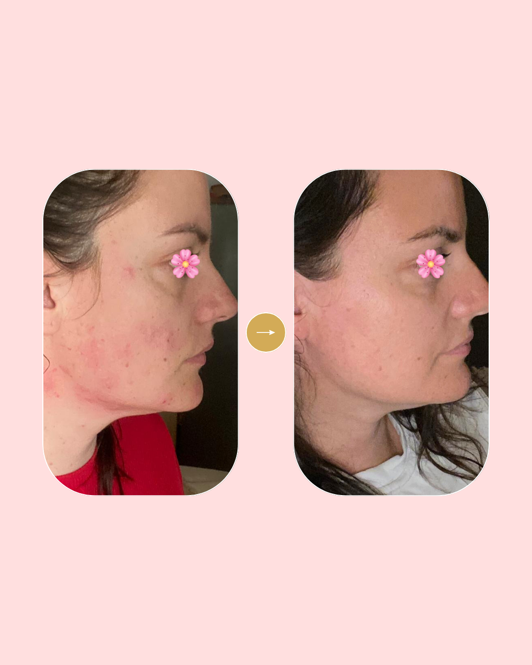 En 28 jours votre peau retrouve toute sa jeunesse